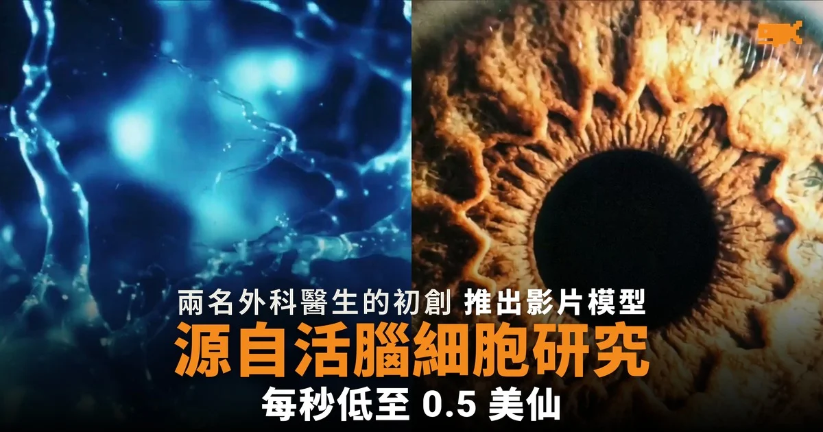 兩名外科醫生的初創推出影片模型 源自活腦細胞研究